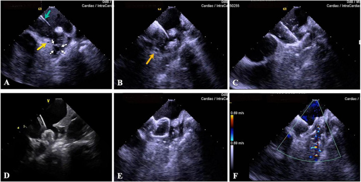 FIGURE 11