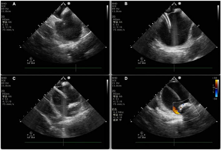 FIGURE 2