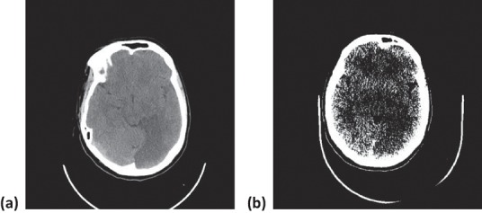 Fig 2.