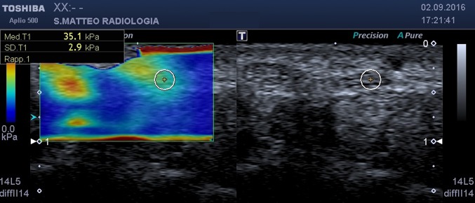Fig. 3