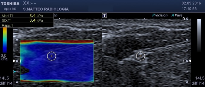 Fig. 1