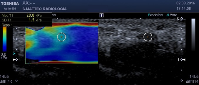 Fig. 2