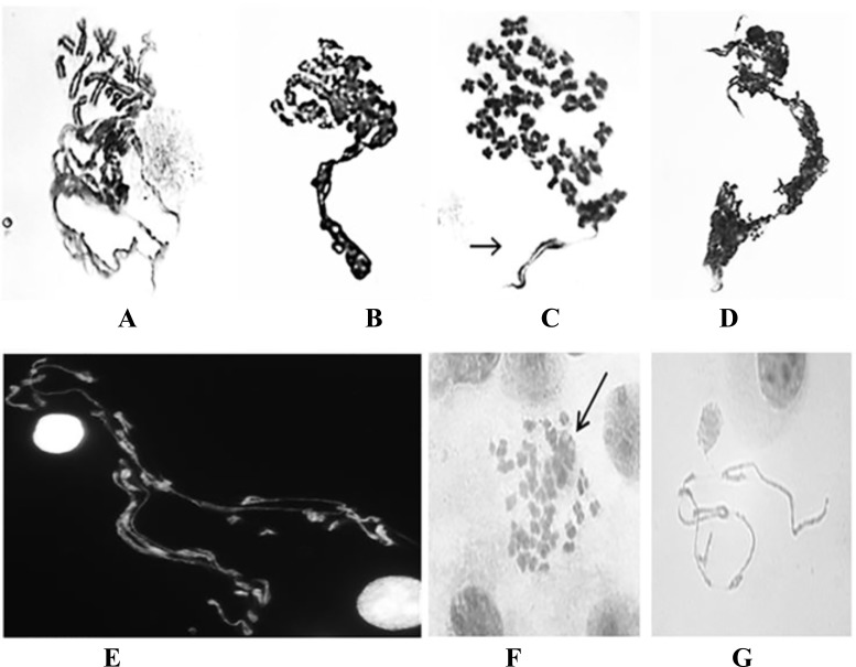 Fig. (1)