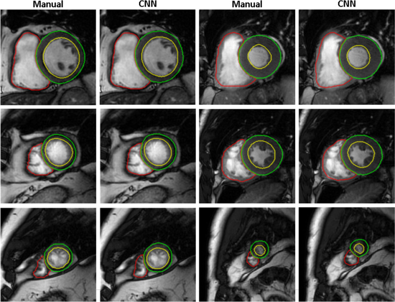 Fig. 2