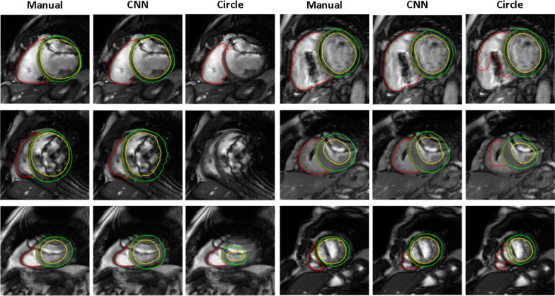 Fig. 4