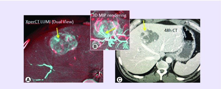 Figure 11. 