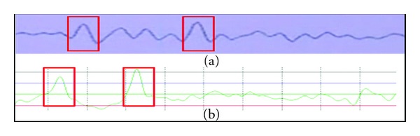 Figure 13