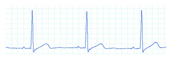 Figure 14