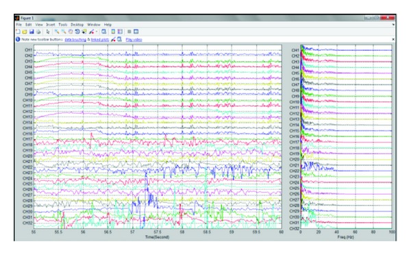 Figure 15