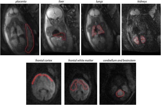 Fig. 2