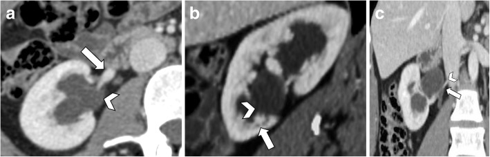 Fig. 13