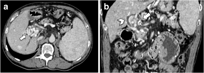 Fig. 19