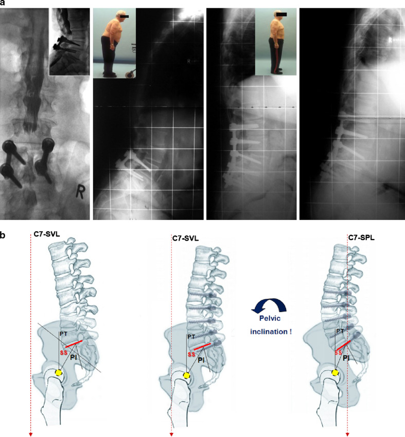 Fig. 3