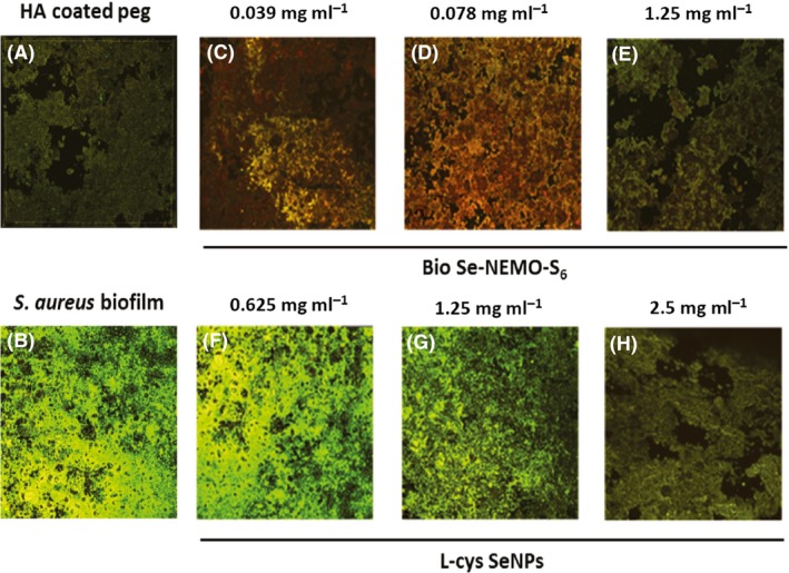 Figure 12