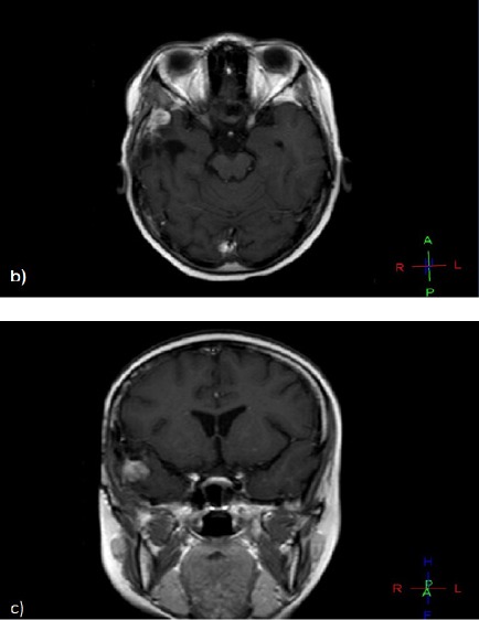 Figure 2b and c