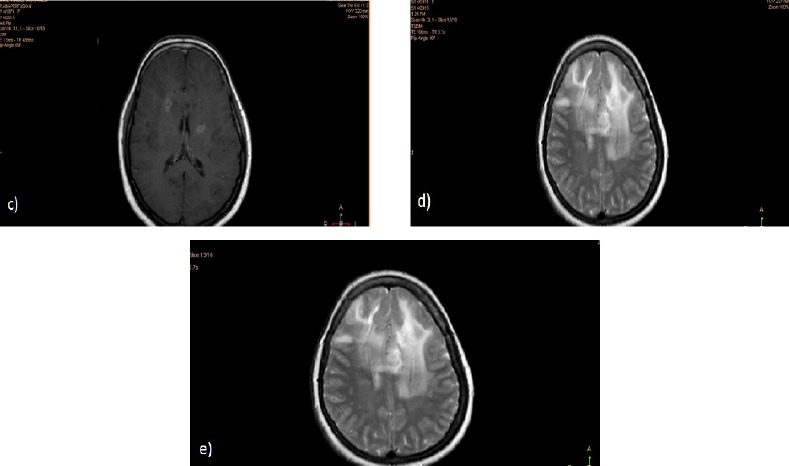 Figure 1c, d and e