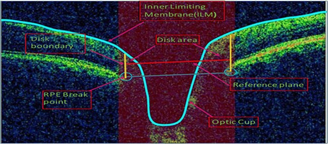 Fig. 2