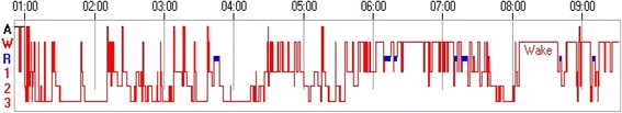 Fig. 2