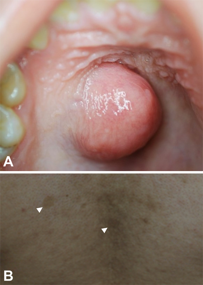 Fig. 1
