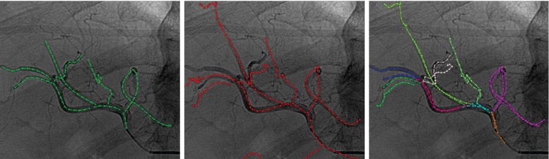 Fig. 10