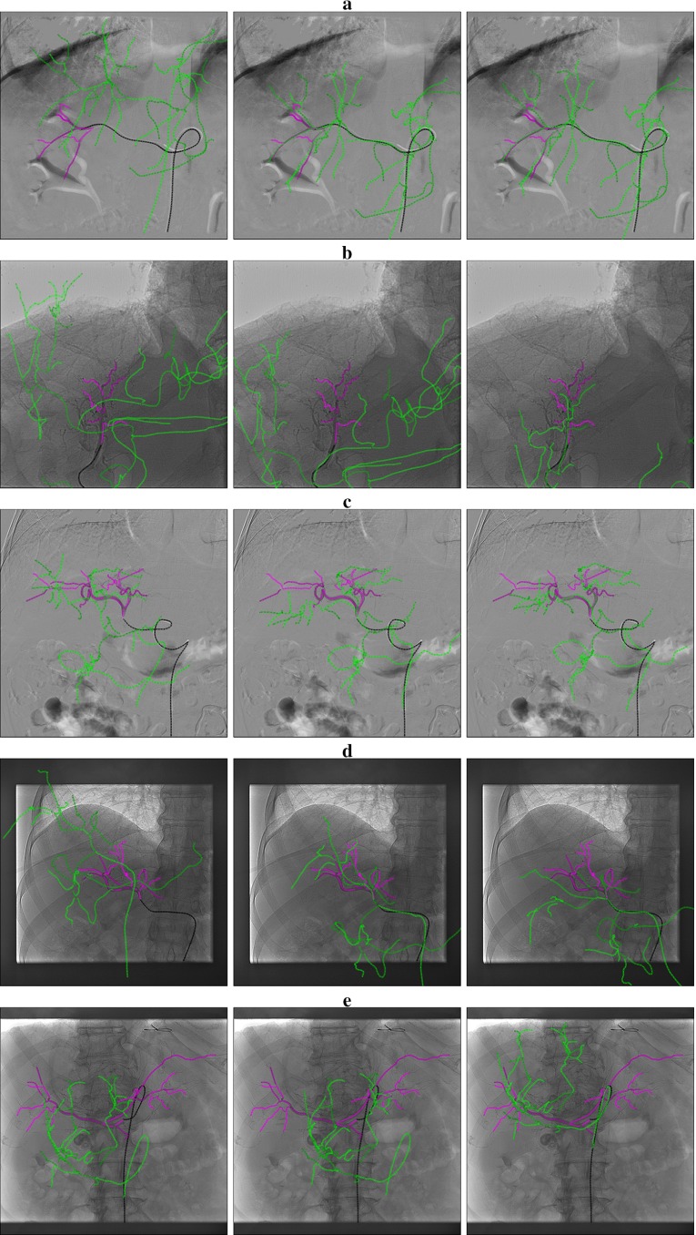 Fig. 16