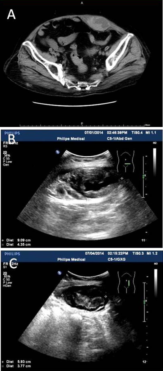 Fig. 1