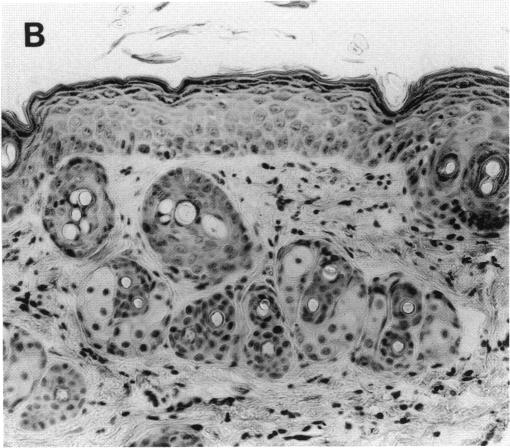 FIGURE 1. B