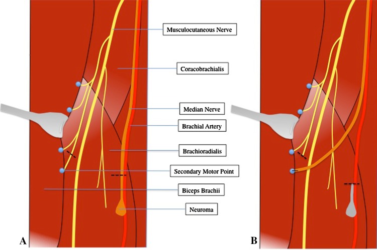 Fig. 1A–B