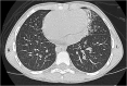 <b>FIG. 2.</b>