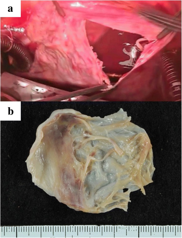 Fig. 5
