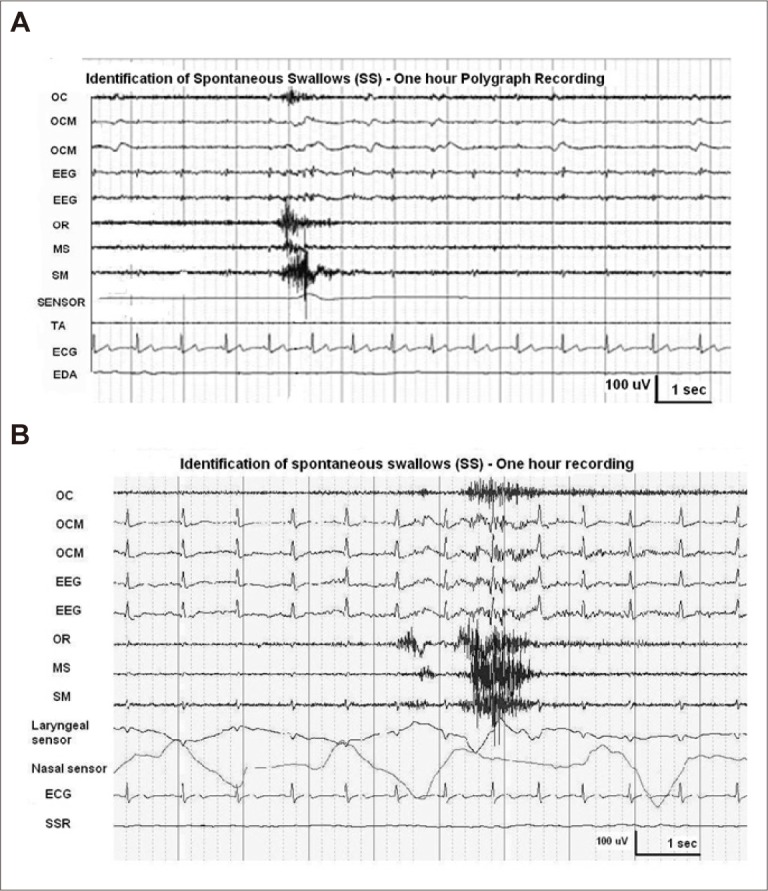 Figure 18.