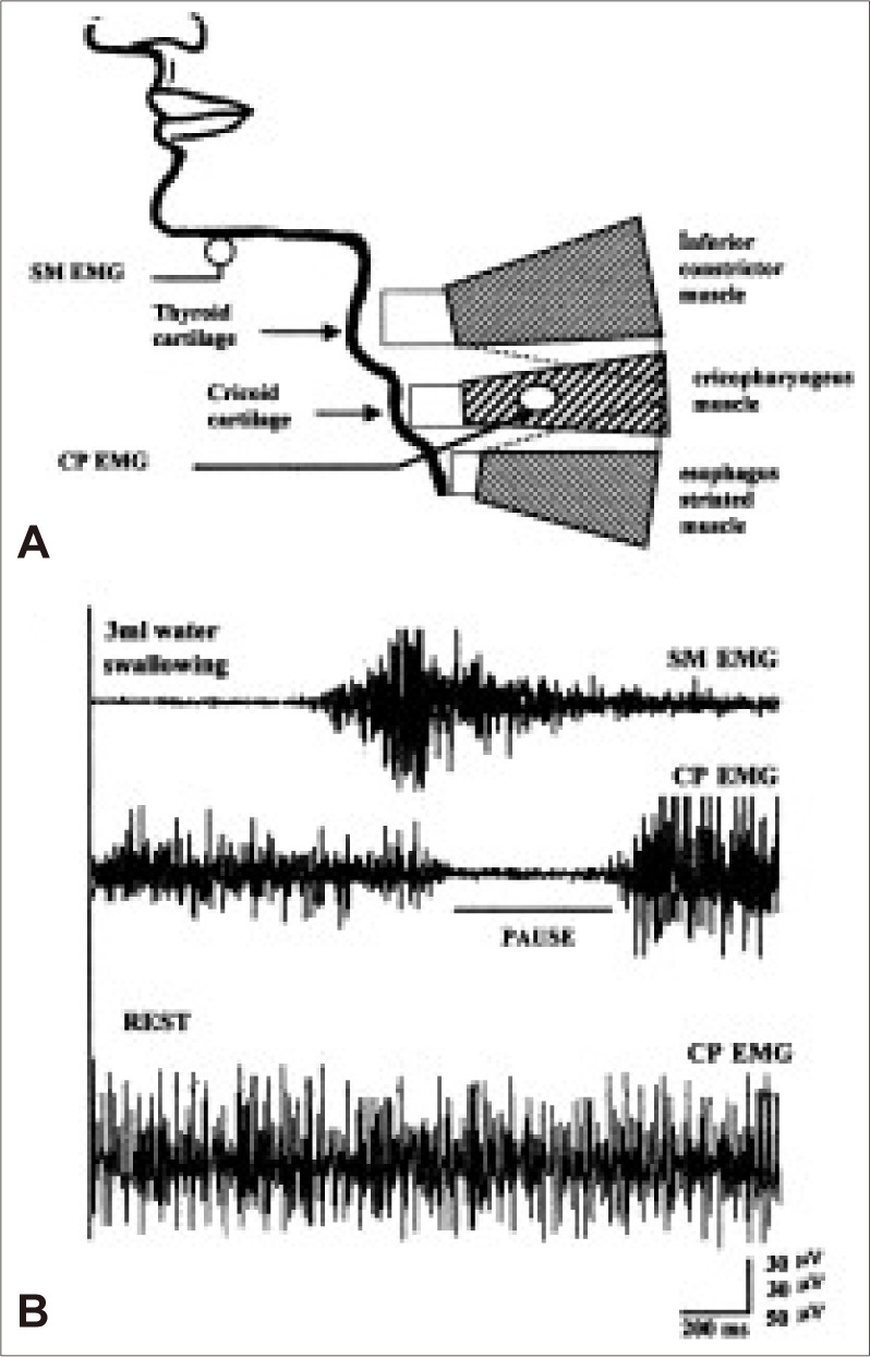 Figure 12.