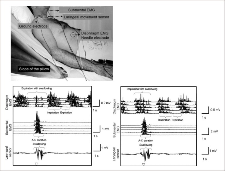 Figure 21.