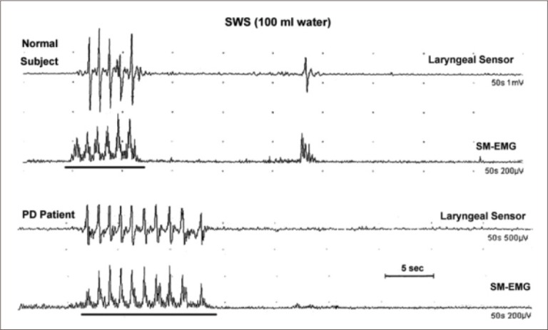 Figure 11.