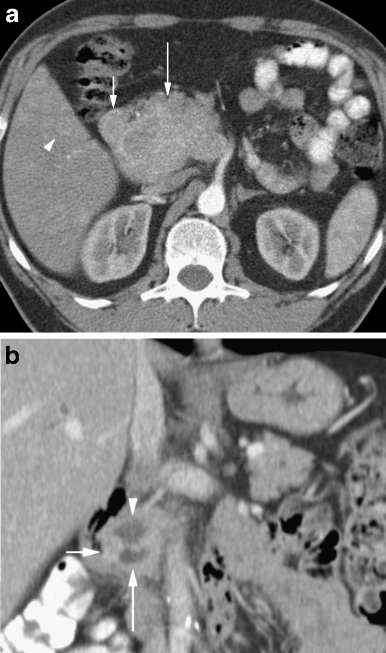 Fig. 12