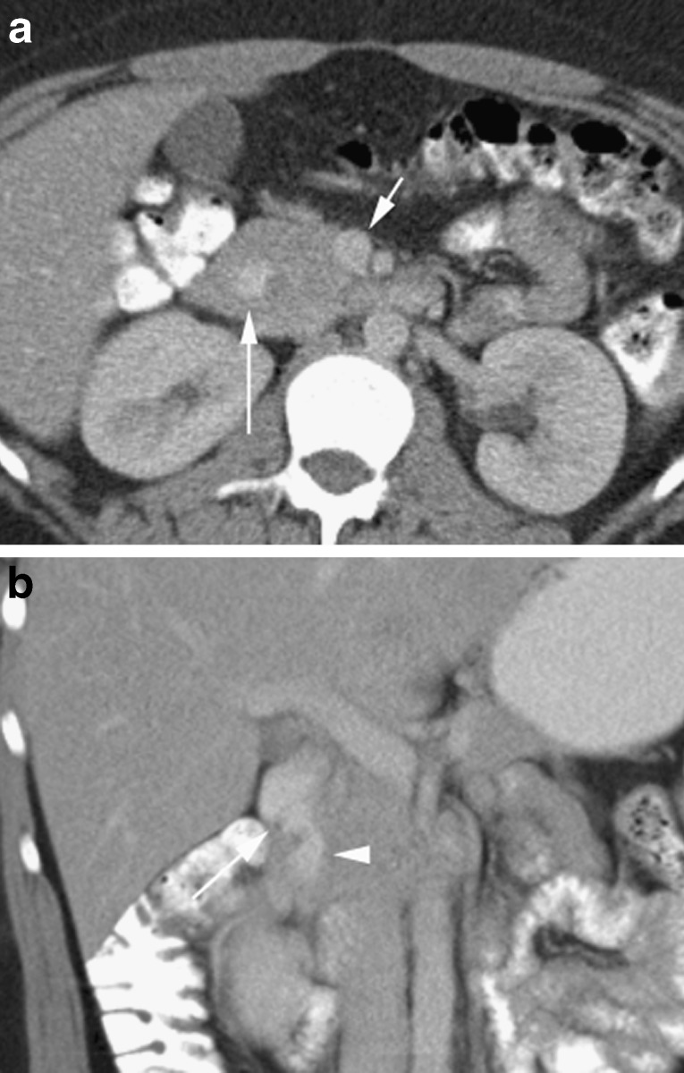 Fig. 13