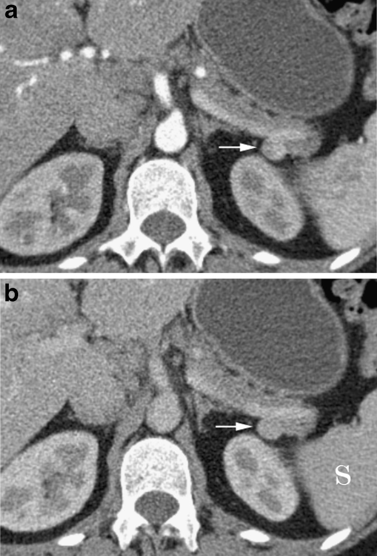 Fig. 10