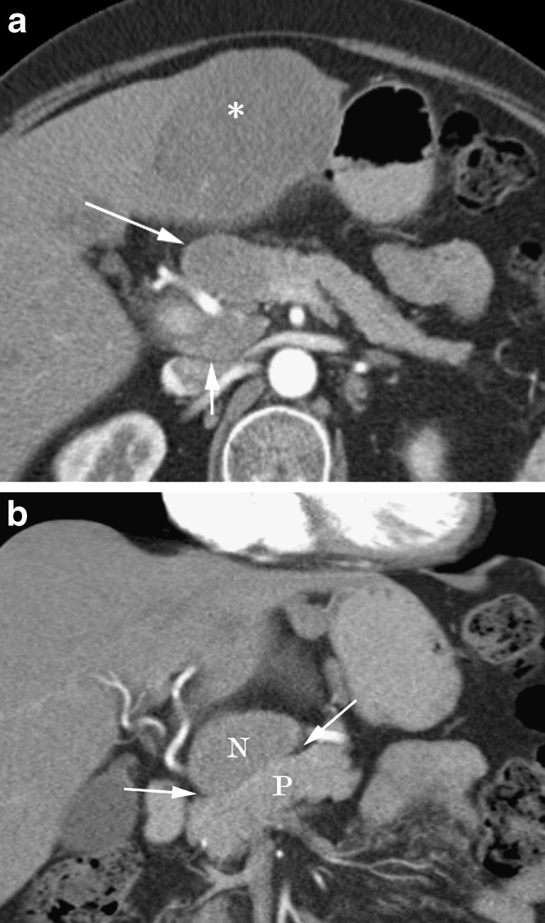 Fig. 15