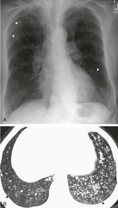 eFigure 33-8