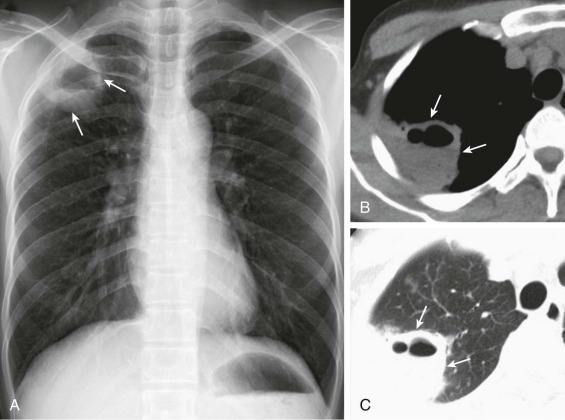 eFigure 33-13