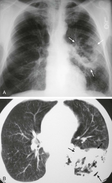 eFigure 33-11