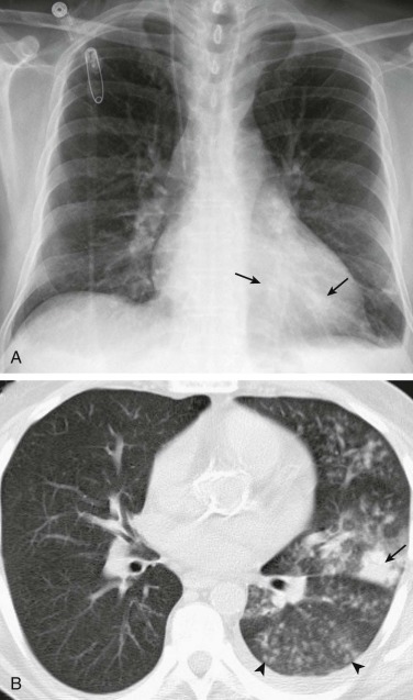 eFigure 33-6