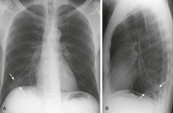 eFigure 33-10