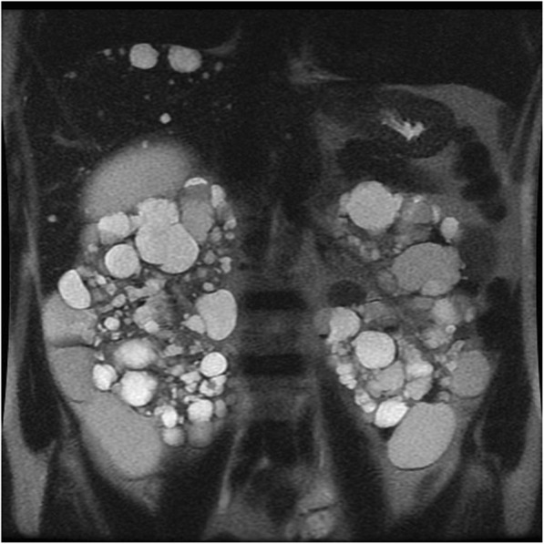 Fig. 11