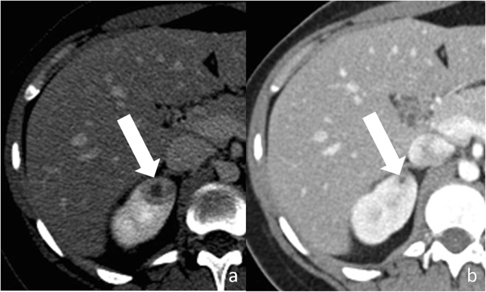 Fig. 10