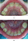 Fig. (1)