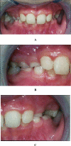 Fig. (2)