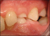 Fig. (4)