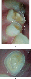 Fig. (3)