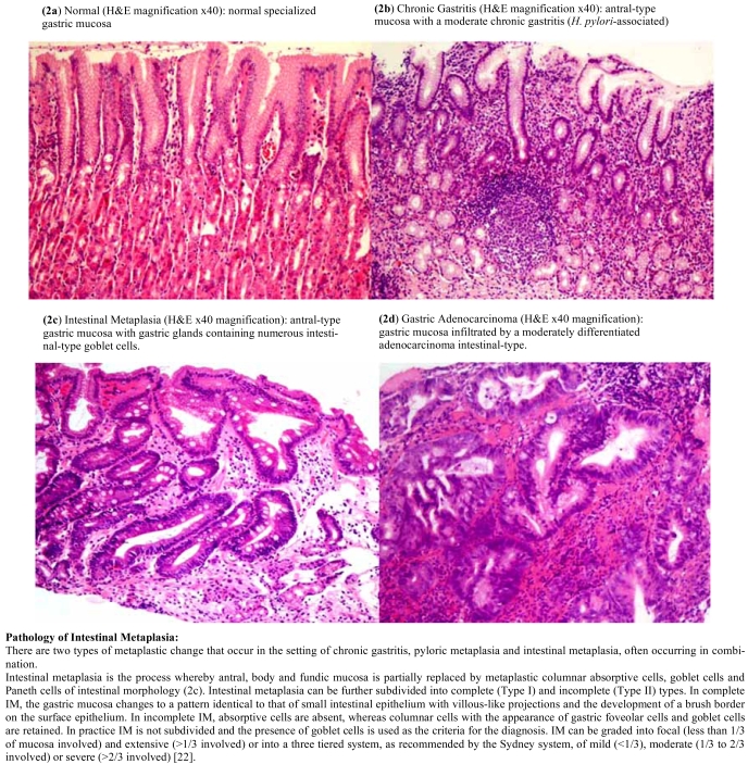 Fig. (2)